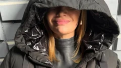Eliana Guercio sufrió una mala praxis estética: ¿qué pasó?