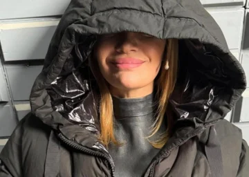 Eliana Guercio sufrió una mala praxis estética: ¿qué pasó?