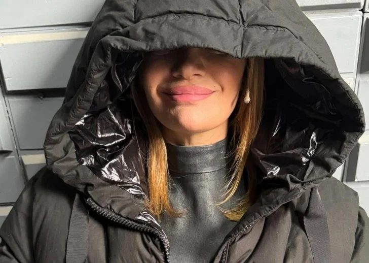 Eliana Guercio sufrió una mala praxis estética: ¿qué pasó?