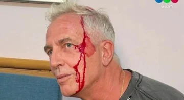 Aparecieron las primeras fotos de Marley tras el accidente en Tailandia