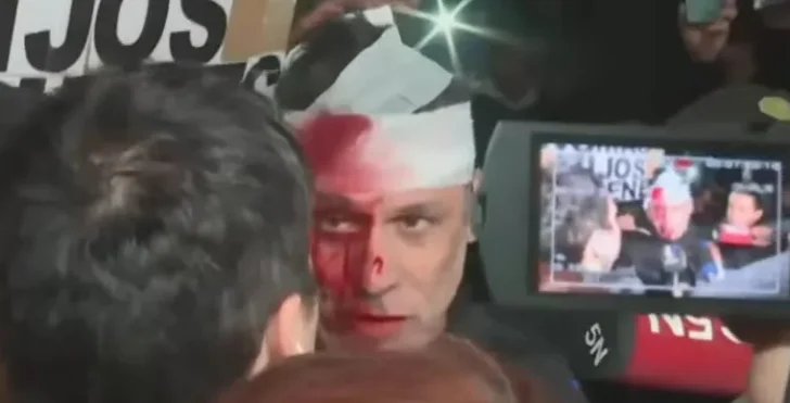Un periodista resultó herido durante el acto de Milei en Moreno