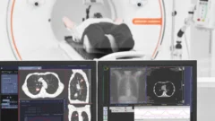 Cáncer en Argentina: 4 de cada 10 casos detectados se podrían prevenir